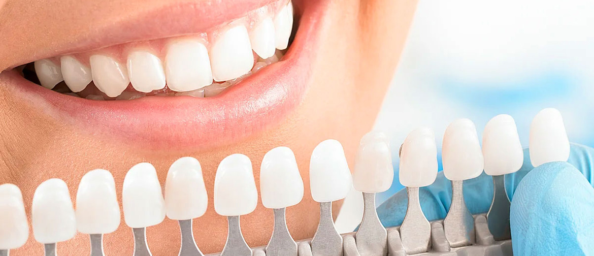 эффективное фотоотбеливание зубов 