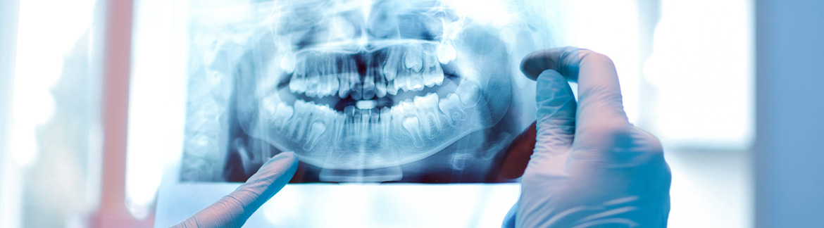 объемный рентгеновский снимок зубов