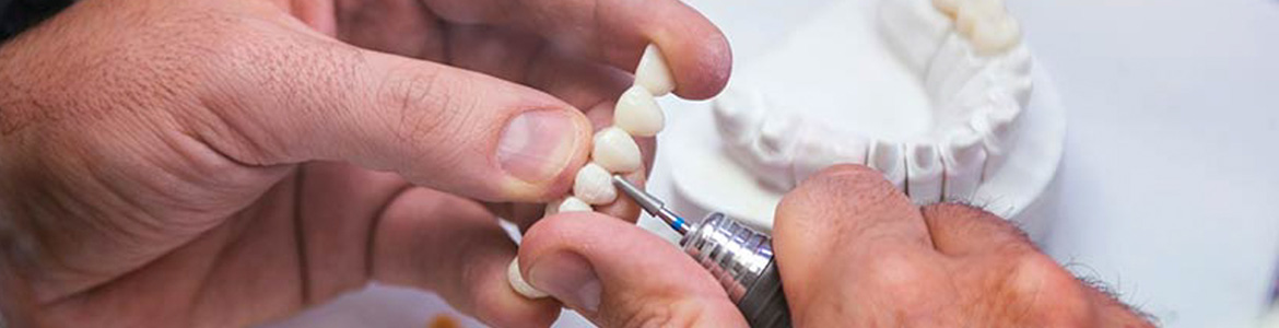 Быстрое изготовление съемных зубных протезов