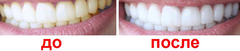 Эффект фотоотбеливания зубов